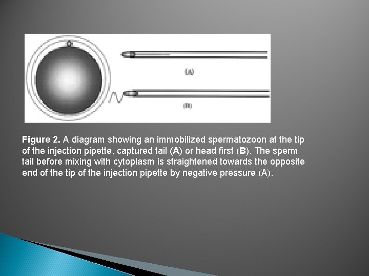 Figure 2. A diagram showing an immobilized spermatozoon at the tip of the injection