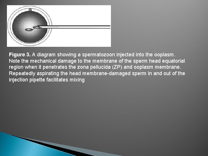 Figure 3. A diagram showing a spermatozoon injected into the ooplasm. Note the mechanical