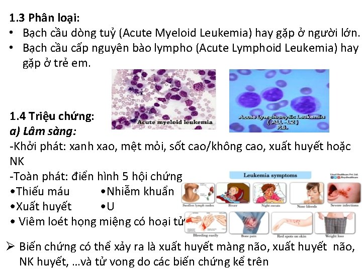 1. 3 Phân loại: • Bạch cầu dòng tuỷ (Acute Myeloid Leukemia) hay gặp