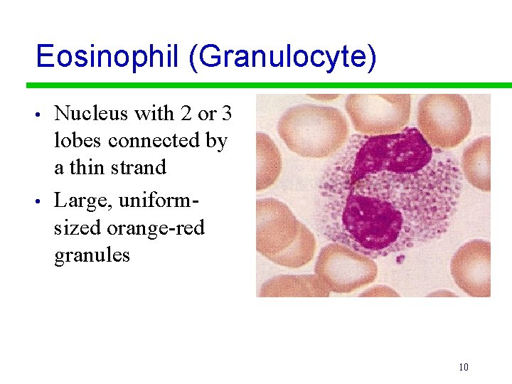 Eosinophil (Granulocyte) • • Nucleus with 2 or 3 lobes connected by a thin