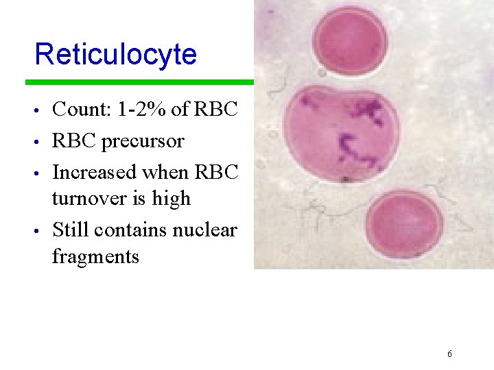 Reticulocyte • • Count: 1 -2% of RBC precursor Increased when RBC turnover is