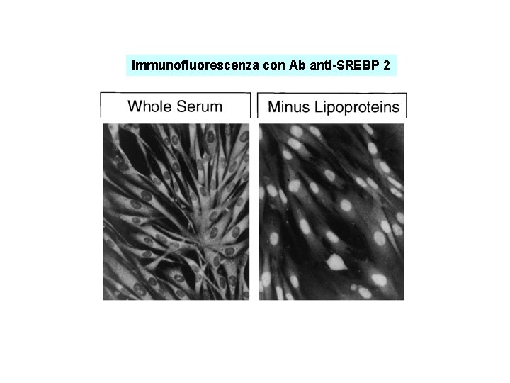 Immunofluorescenza con Ab anti-SREBP 2 