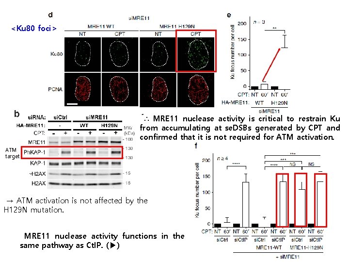 <Ku 80 foci> ∴ MRE 11 nuclease activity is critical to restrain Ku from