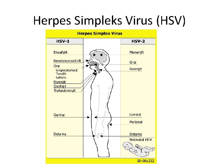 Herpes Simpleks Virus (HSV) 