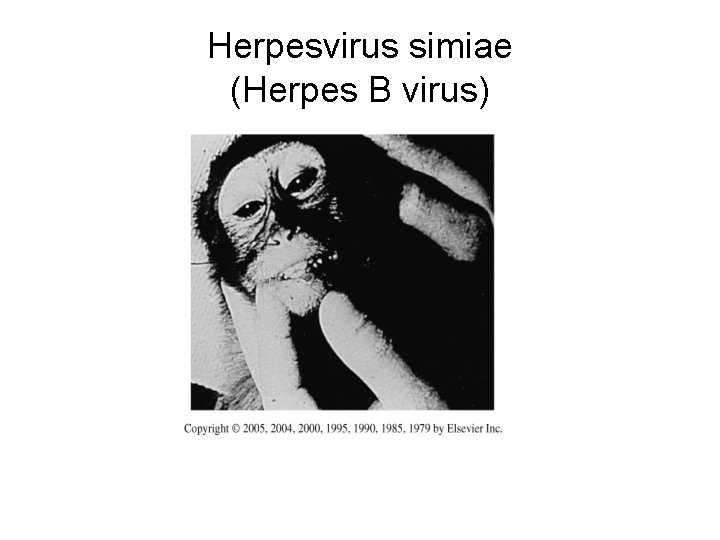 Herpesvirus simiae (Herpes B virus) 