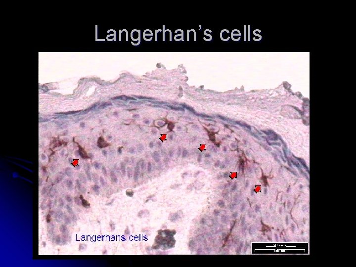 Langerhan’s cells 