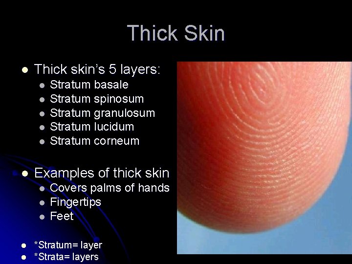Thick Skin l Thick skin’s 5 layers: l l l Examples of thick skin
