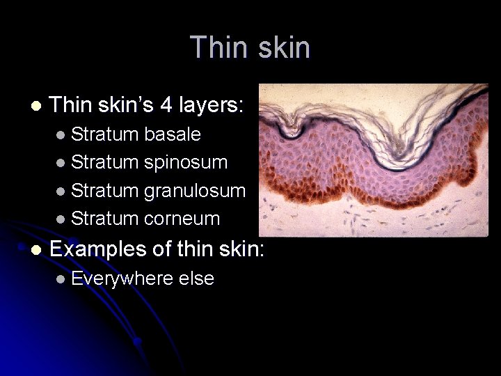 Thin skin l Thin skin’s 4 layers: l Stratum basale l Stratum spinosum l