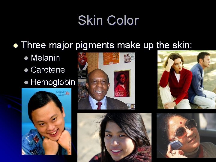 Skin Color l Three major pigments make up the skin: l Melanin l Carotene