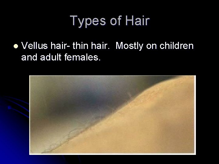 Types of Hair l Vellus hair- thin hair. Mostly on children and adult females.