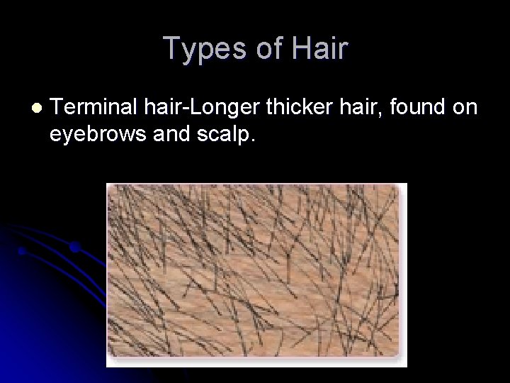 Types of Hair l Terminal hair-Longer thicker hair, found on eyebrows and scalp. 