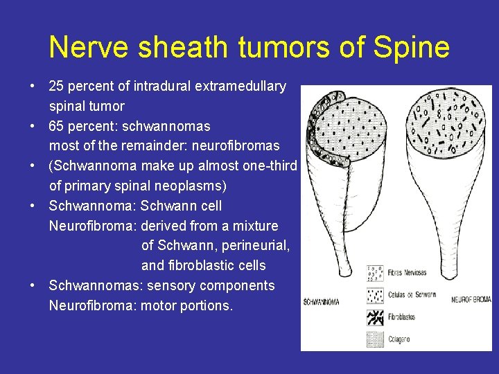 Nerve sheath tumors of Spine • 25 percent of intradural extramedullary spinal tumor •