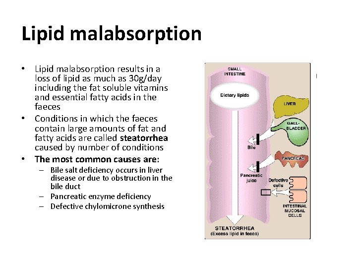 Lipid malabsorption • Lipid malabsorption results in a loss of lipid as much as