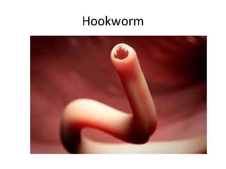 Hookworm 
