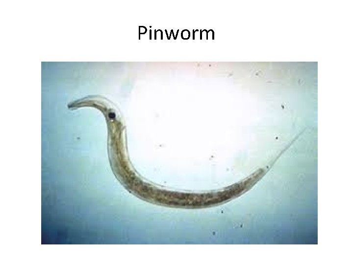 Pinworm 