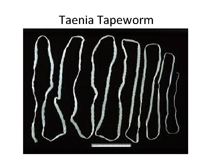 Taenia Tapeworm 