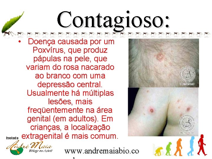 Contagioso: • Doença causada por um Poxvírus, que produz pápulas na pele, que variam