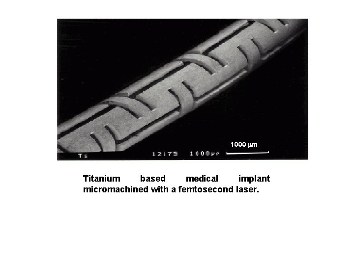 1000 m Titanium based medical implant micromachined with a femtosecond laser. 