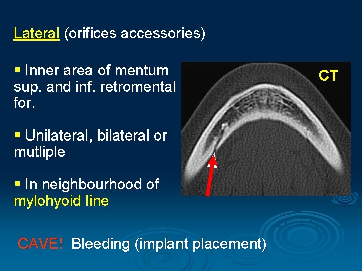 Lateral (orifices accessories) § Inner area of mentum sup. and inf. retromental for. §
