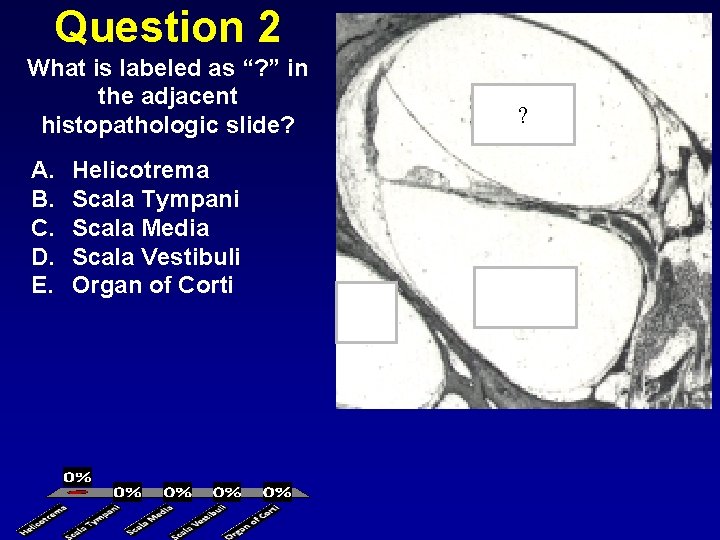 Question 2 What is labeled as “? ” in the adjacent histopathologic slide? A.