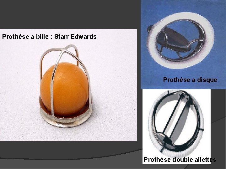 Prothèse a bille : Starr Edwards Prothèse a disque Prothèse double ailettes 