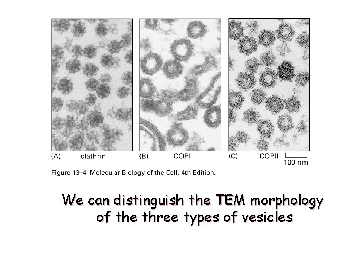 We can distinguish the TEM morphology of the three types of vesicles 