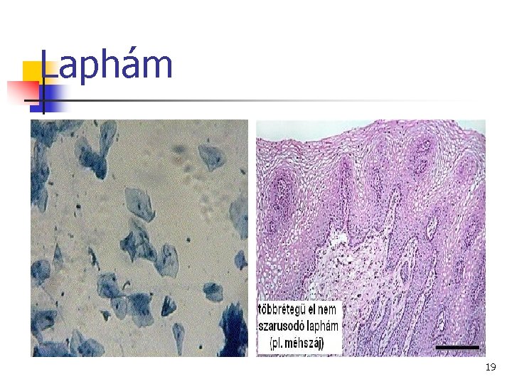 Laphám 19 Laphám 19