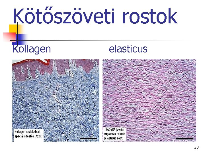 Kötőszöveti rostok kollagen elasticus 23 