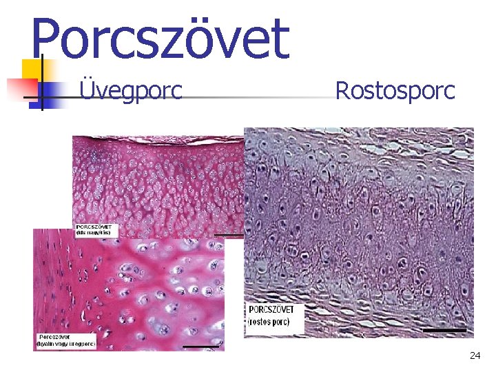 Porcszövet Üvegporc Rostosporc 24 Porcszövet Üvegporc Rostosporc 24