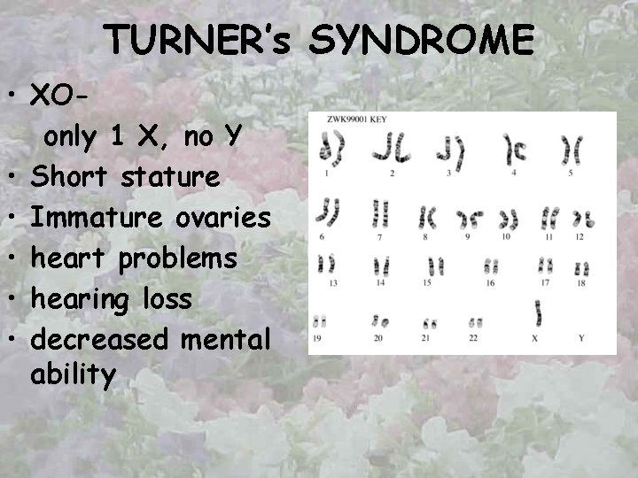 TURNER’s SYNDROME • XOonly 1 X, no Y • Short stature • Immature ovaries