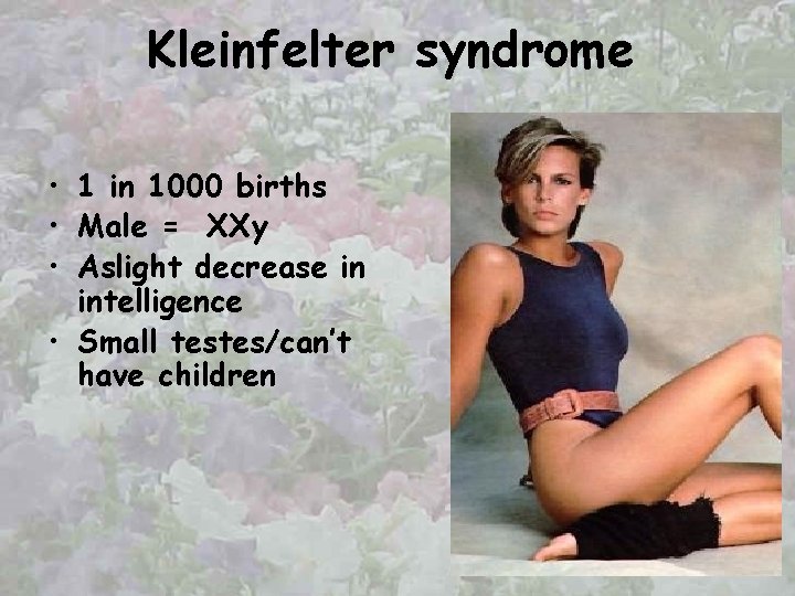 Kleinfelter syndrome • 1 in 1000 births • Male = XXy • Aslight decrease