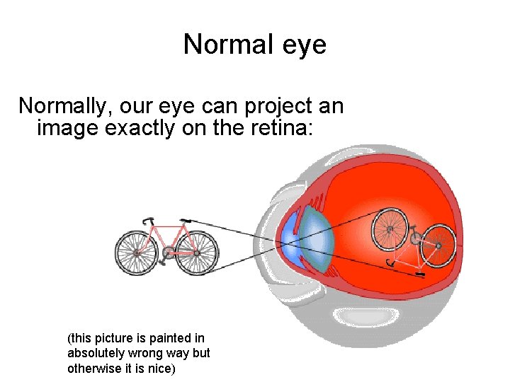 Normal eye Normally, our eye can project an image exactly on the retina: (this