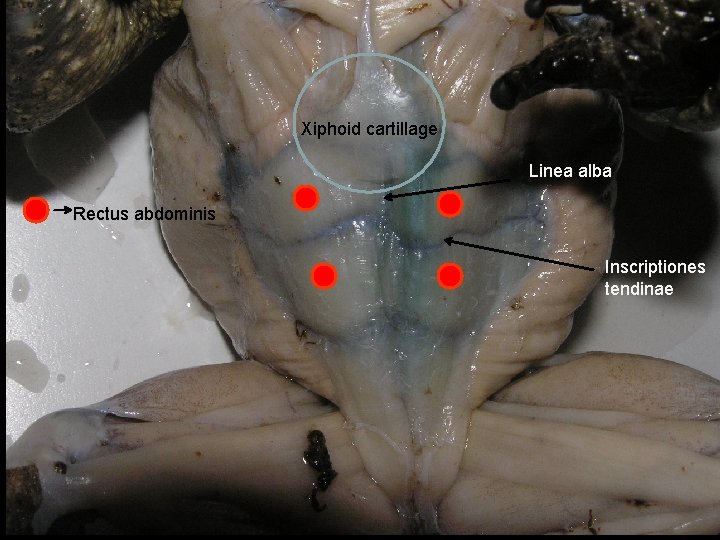 Xiphoid cartillage Linea alba Rectus abdominis Inscriptiones tendinae 