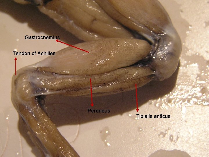 Gastrocnemius Tendon of Achilles Peroneus Tibialis anticus 