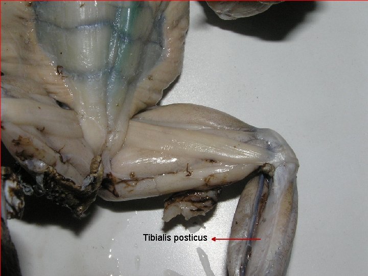 Tibialis posticus 