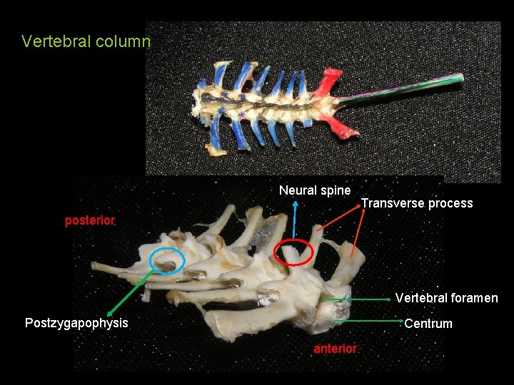 Vertebral column Neural spine Transverse process posterior Vertebral foramen Postzygapophysis Centrum anterior 
