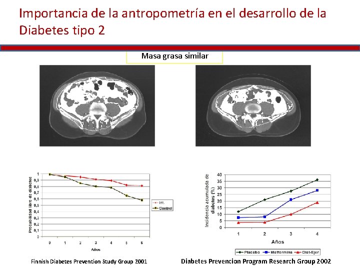 Importancia de la antropometría en el desarrollo de la Diabetes tipo 2 Masa grasa