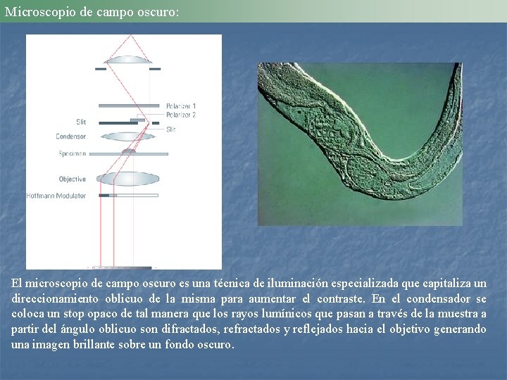 Microscopio de campo oscuro: El microscopio de campo oscuro es una técnica de iluminación