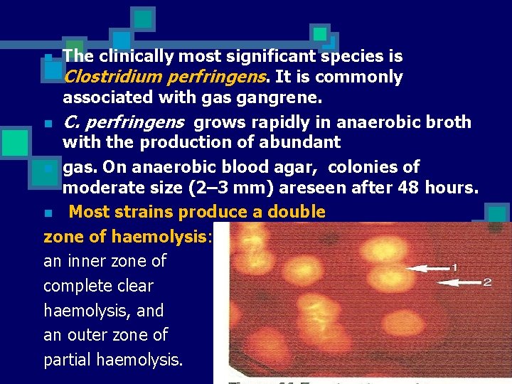 The clinically most significant species is Clostridium perfringens. It is commonly associated with gas