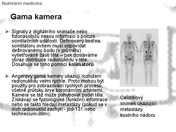 Nukleární medicína Gama kamera Ø Signály z digitálního snímače nebo fotonásobičů nesou informaci o