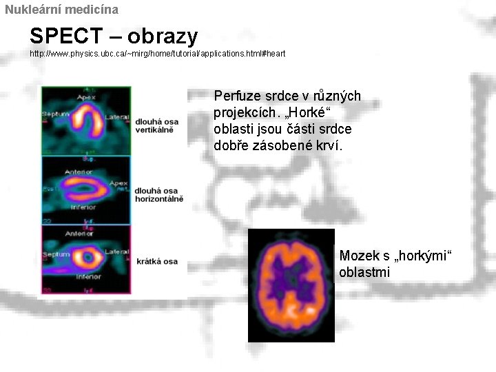 Nukleární medicína SPECT – obrazy http: //www. physics. ubc. ca/~mirg/home/tutorial/applications. html#heart Perfuze srdce v