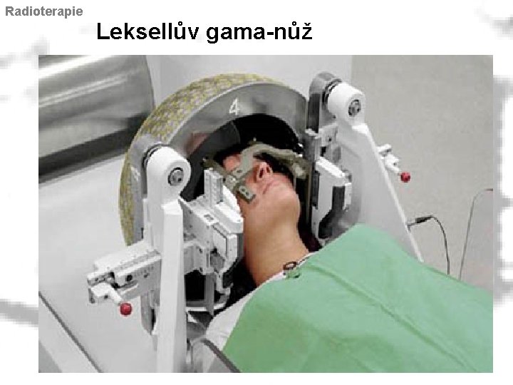 Radioterapie Leksellův gama-nůž 