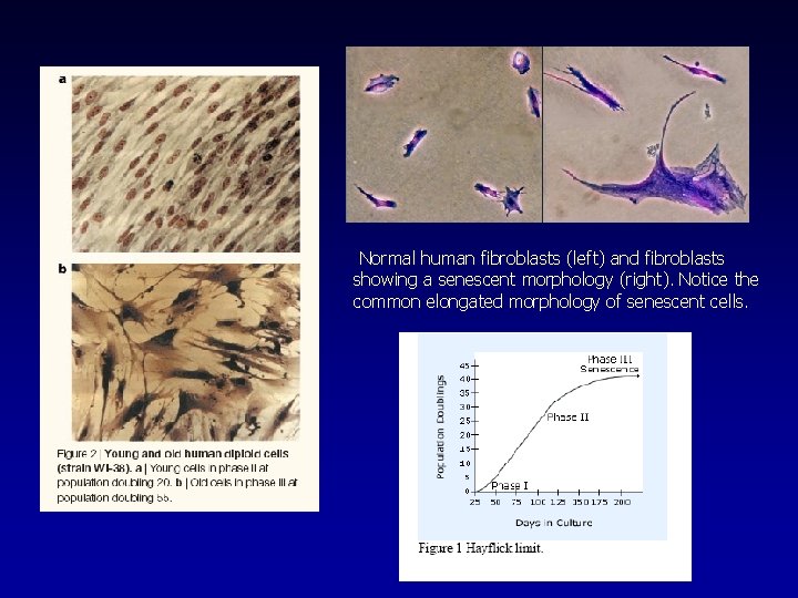  Normal human fibroblasts (left) and fibroblasts showing a senescent morphology (right). Notice the