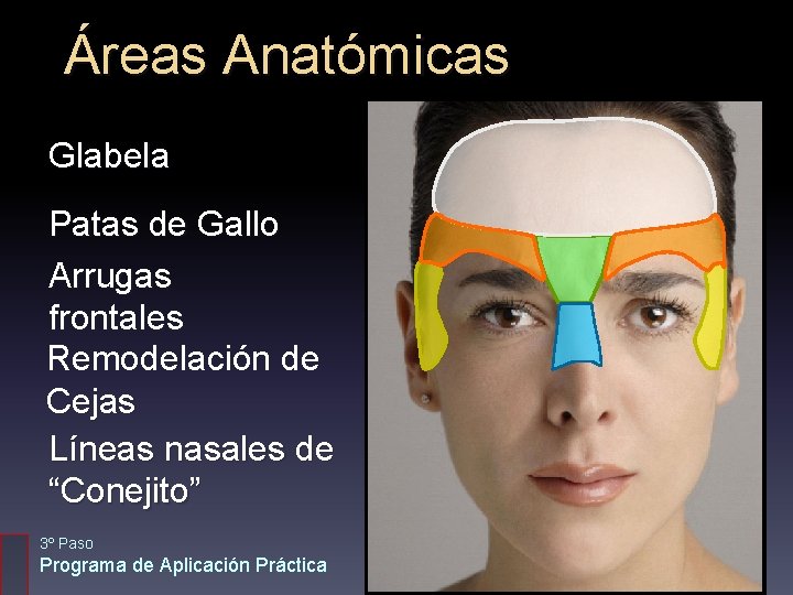 Áreas Anatómicas Glabela Patas de Gallo Arrugas frontales Remodelación de Cejas Líneas nasales de