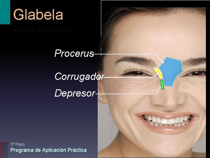 Glabela Base Muscular Procerus Corrugador Depresor 3º Paso Programa de Aplicación Práctica 