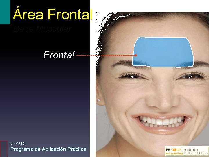 Área Frontal Base Muscular Frontal 3º Paso Programa de Aplicación Práctica 