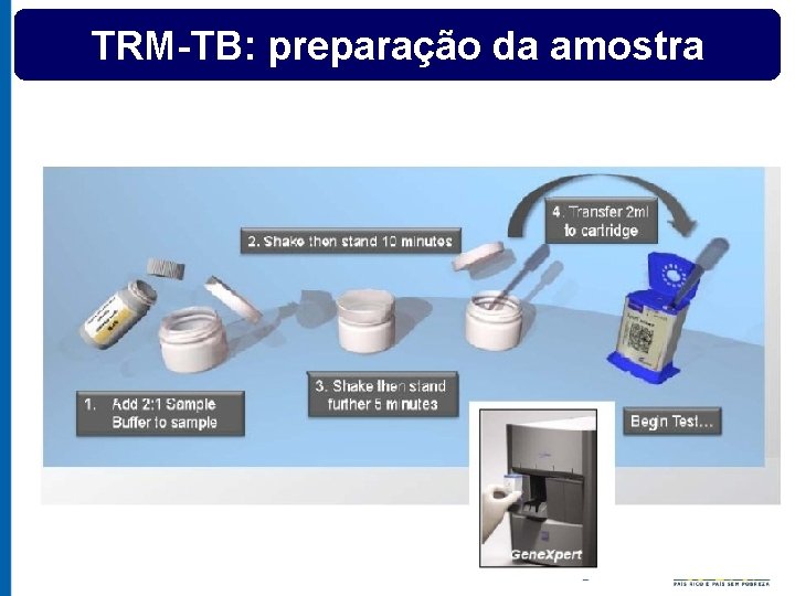 TRM-TB: preparação da amostra 
