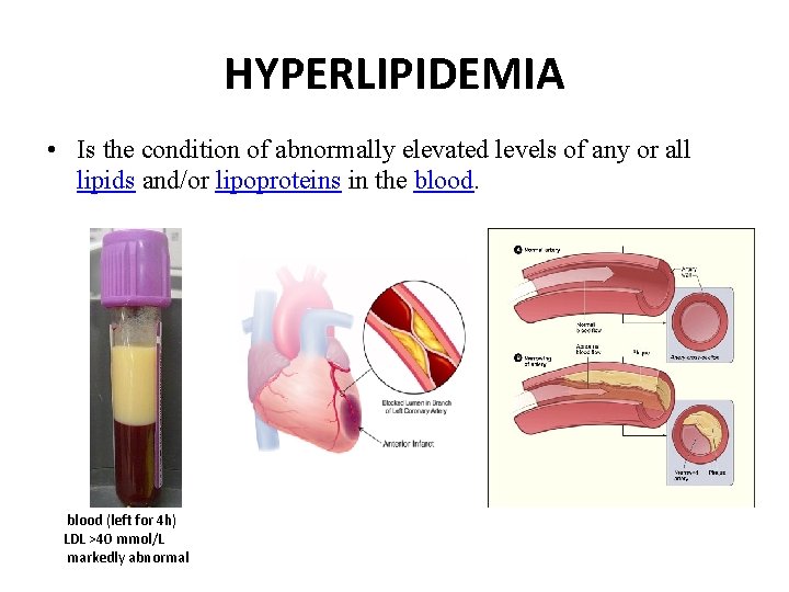 HYPERLIPIDEMIA • Is the condition of abnormally elevated levels of any or all lipids