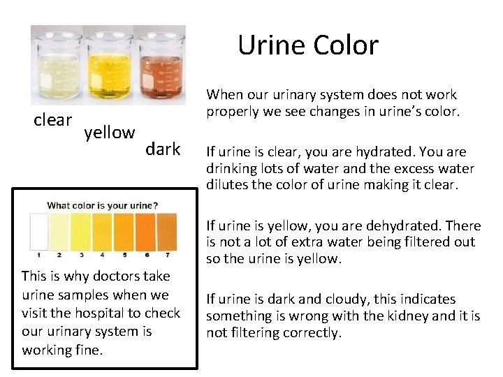 Urine Color clear yellow When our urinary system does not work properly we see