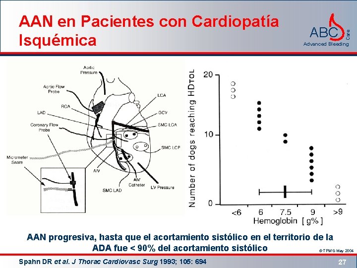 ABC Care AAN en Pacientes con Cardiopatía Isquémica Advanced Bleeding AAN progresiva, hasta que